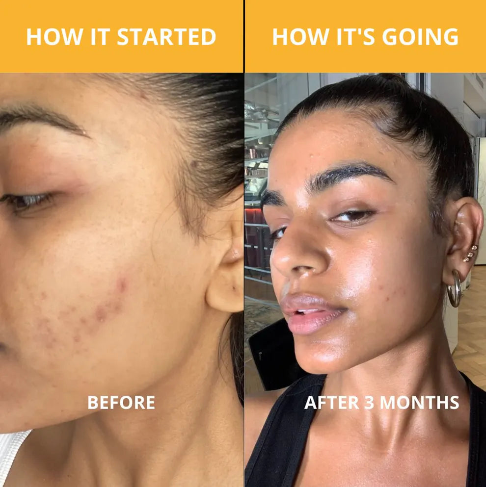 Radiant Glow Exfoliating Spray™