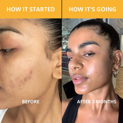 Radiant Glow Exfoliating Spray™