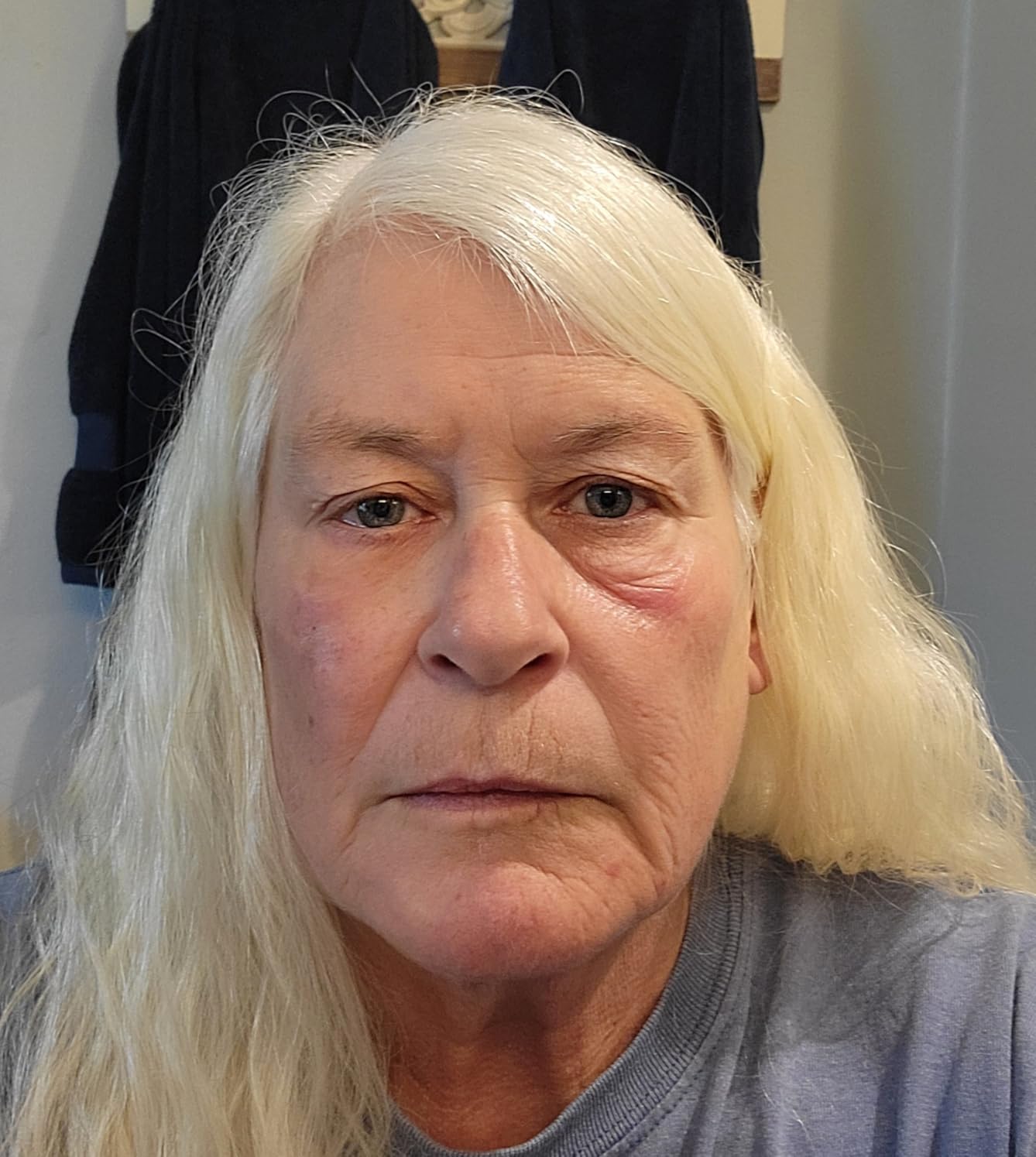 Instant FIRMx® Eye Tightener - NEW IMPROVED FORMULA