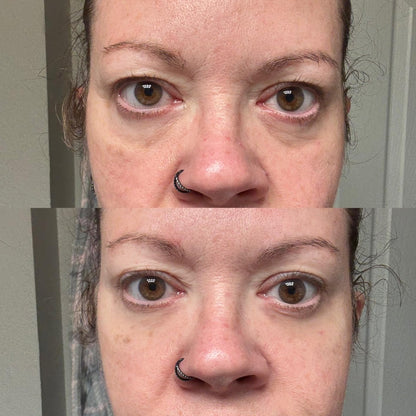 Instant FIRMx® Eye Tightener - NEW IMPROVED FORMULA