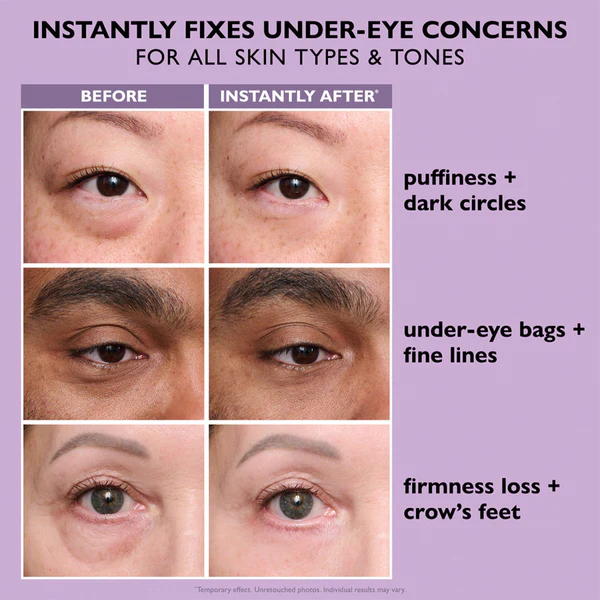 Instant FIRMx® Eye Tightener - NEW IMPROVED FORMULA
